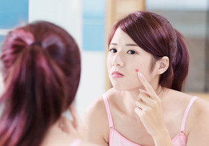 木兰游记图文-好物分享！战痘神器，高能祛痘，轻松摆脱痘痘烦恼！！！