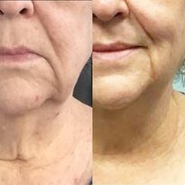 Paradise Wellness Med Spa-博蒙特必去景点