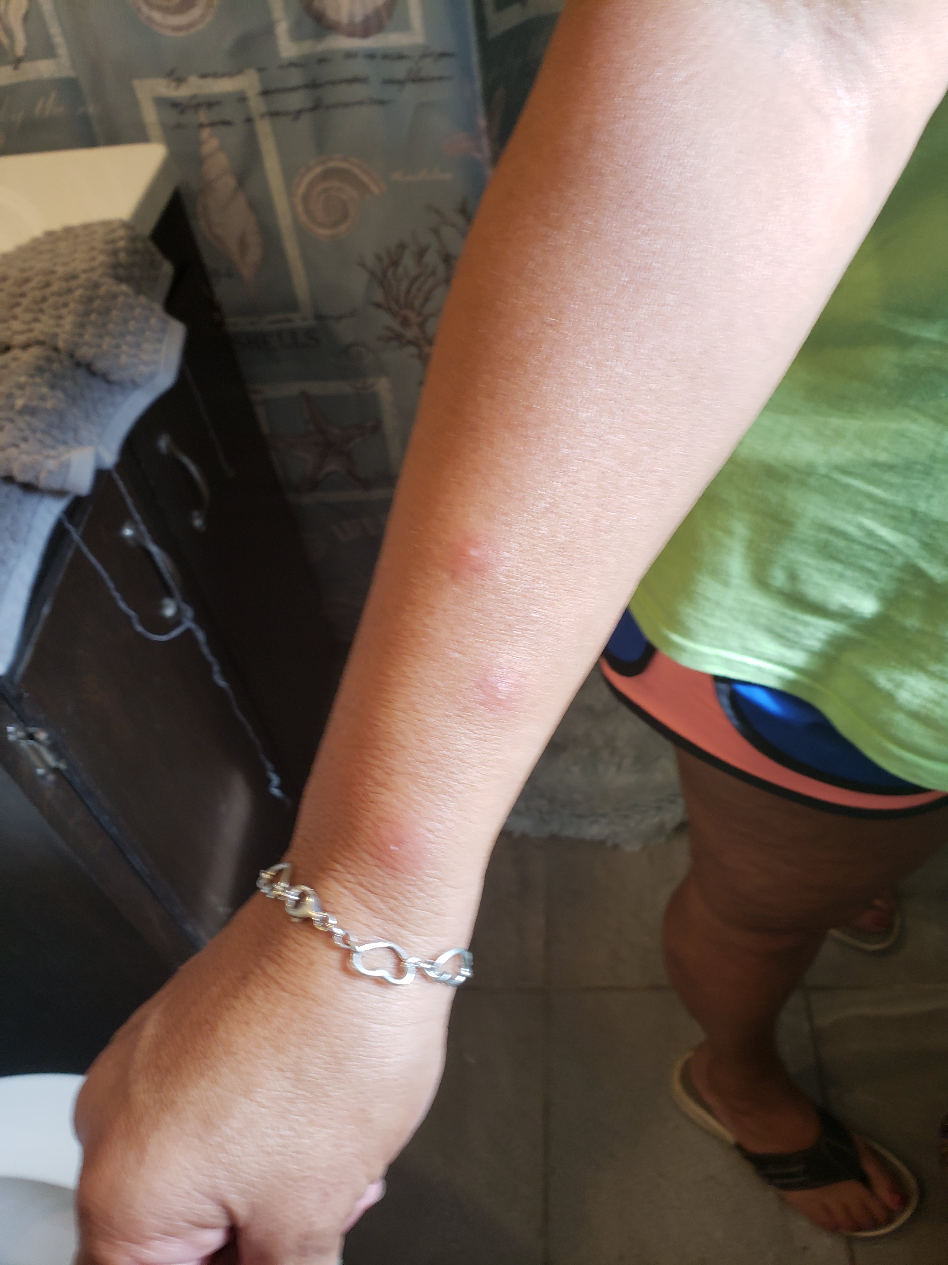 Hilton Garden Inn Dalton-portrait