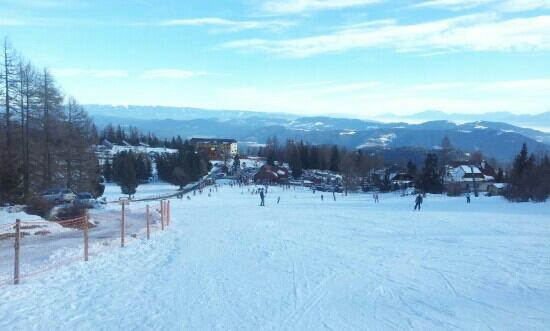 Hochrindl Kegel-锡尔尼兹必去景点