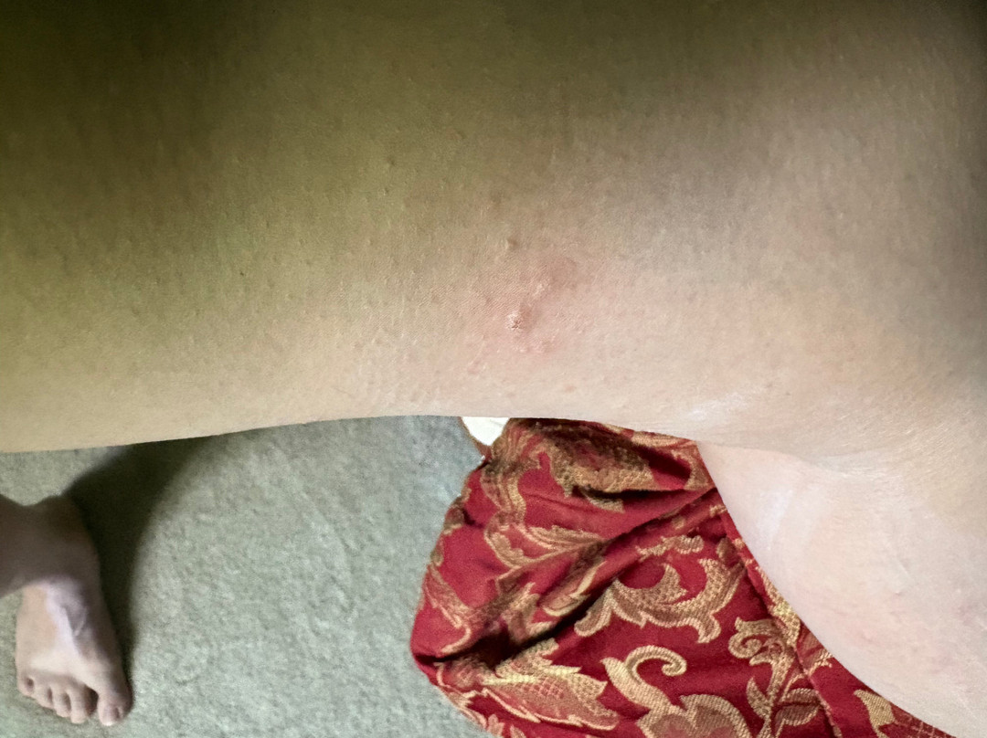 罗切斯特/梅奥诊所区凯悦嘉寓酒店主图