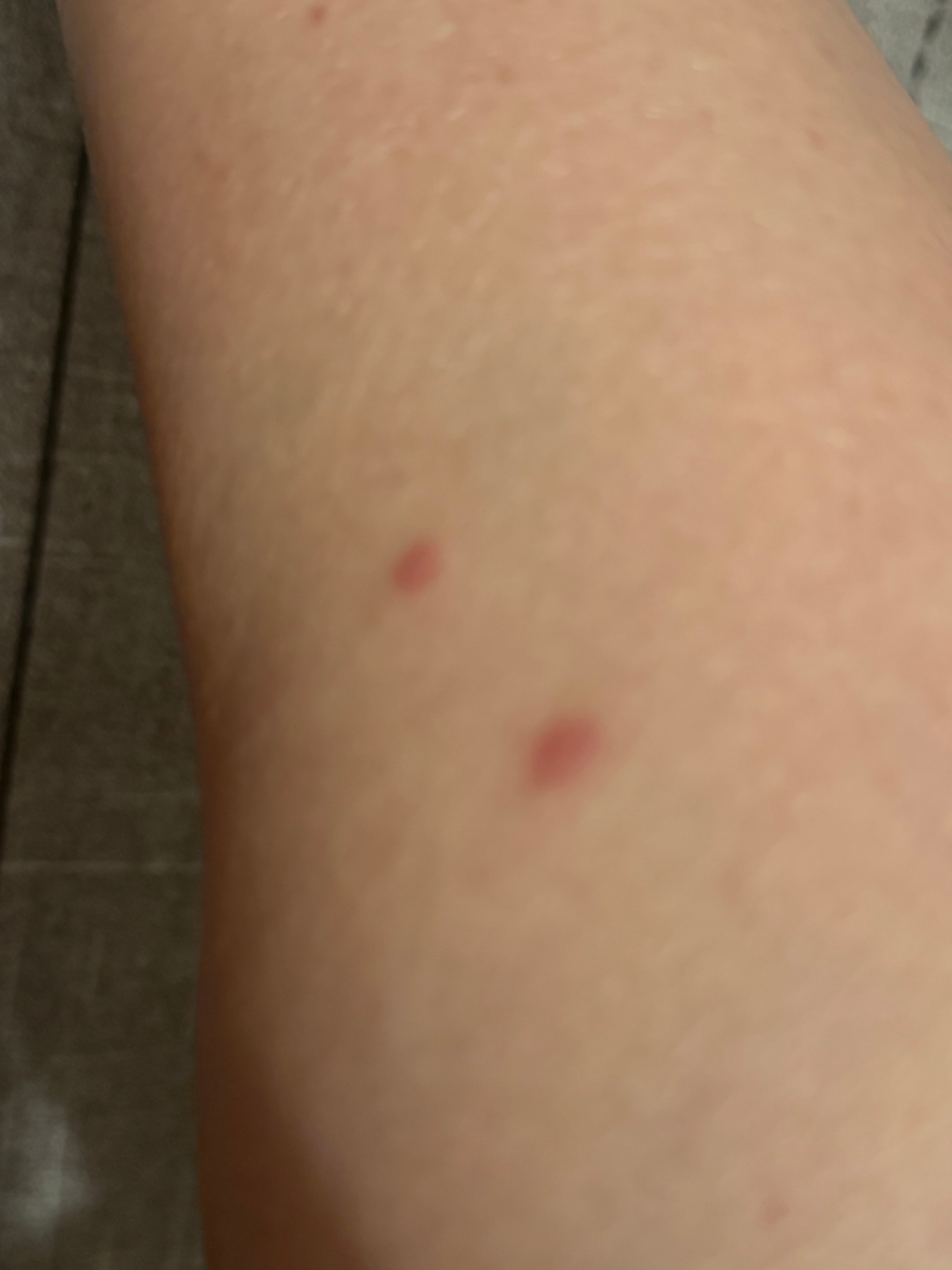 Hotel Lilienhof-官方