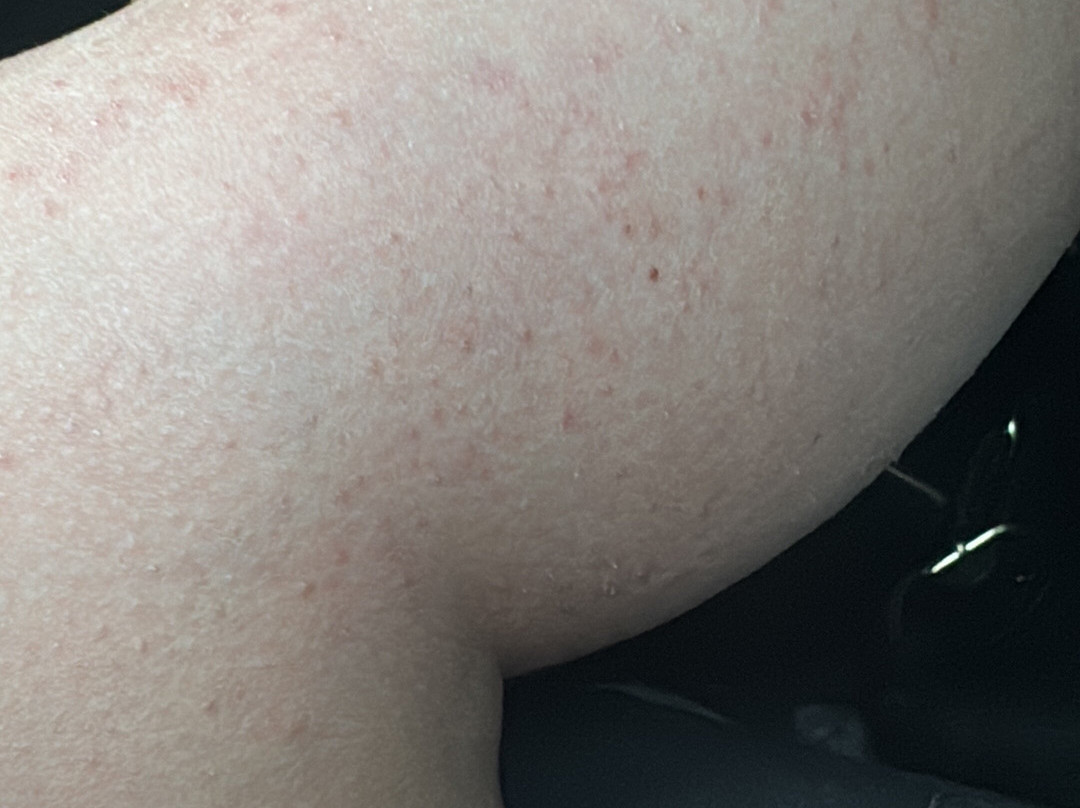 费德里克二世酒店主图