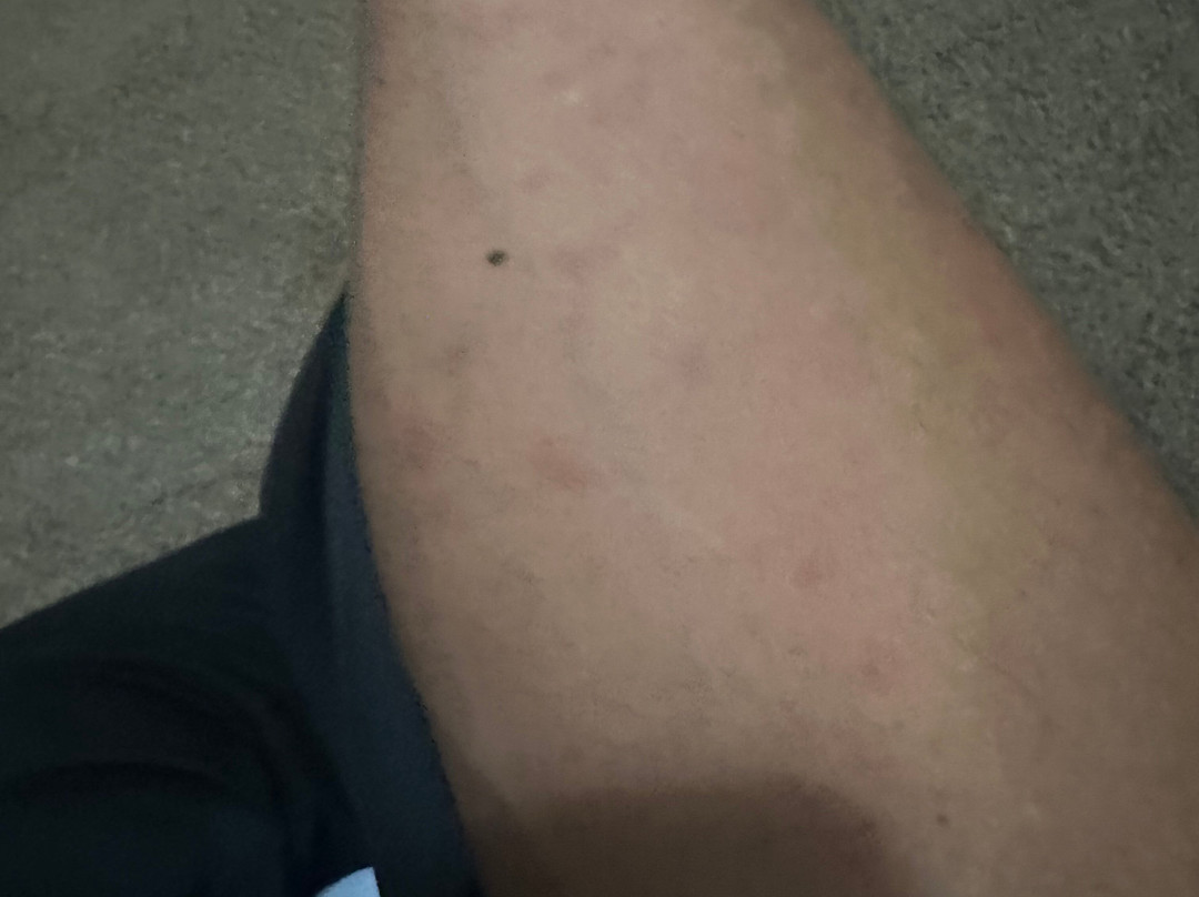 Clarion Pointe Bettendorf - Quad Cities主图