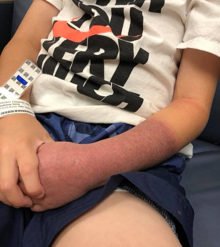 Omni Interlocken Hotel主图