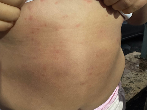 彭塔波林奎恩度假村主图