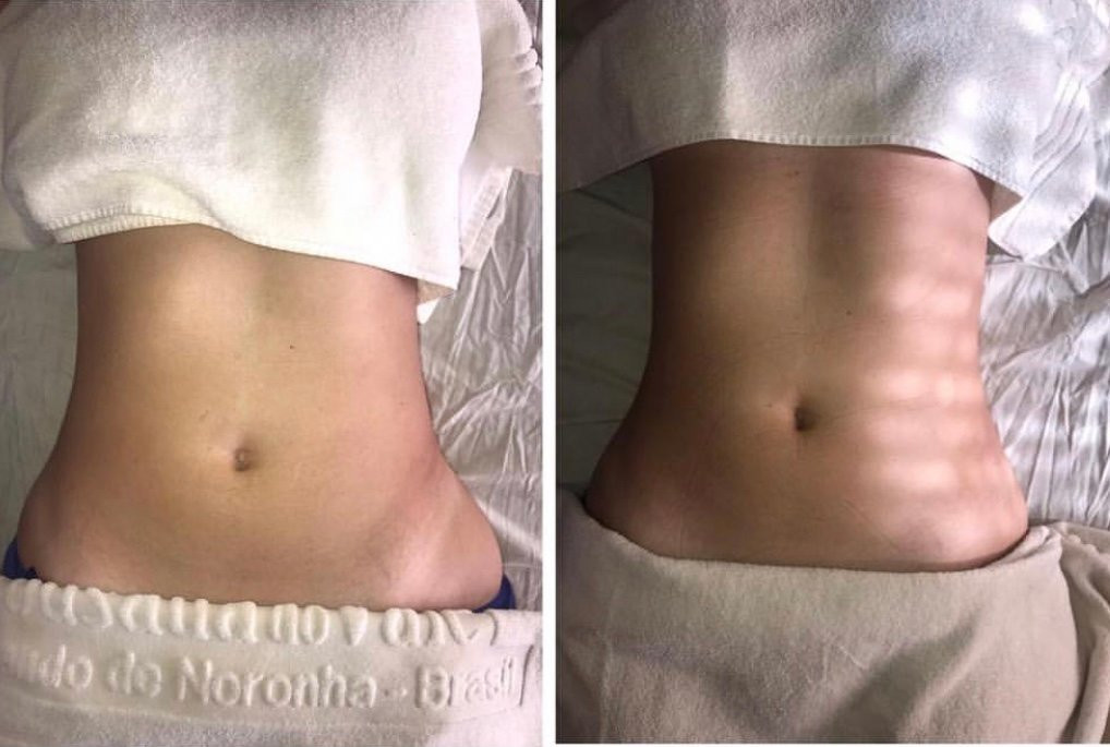 Spanoronha By Tati Miani-费尔南多-迪诺罗尼亚群岛必去景点