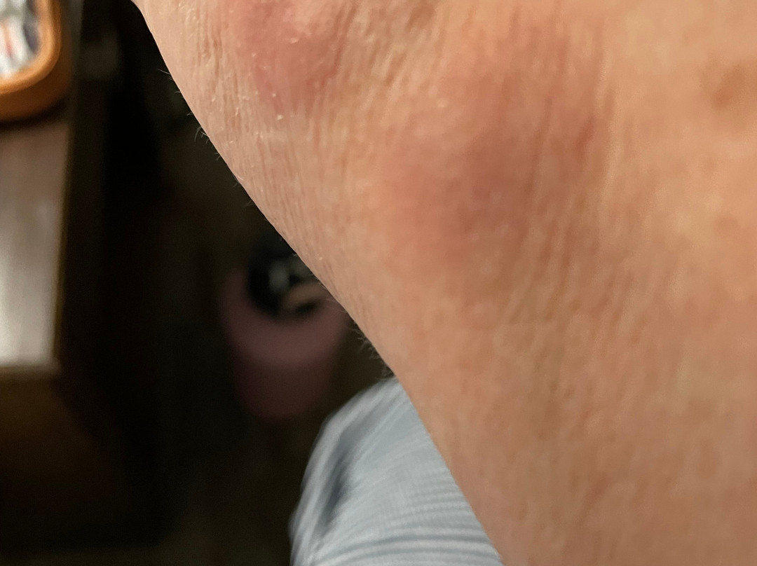 迈诺特呗盟套房酒店主图