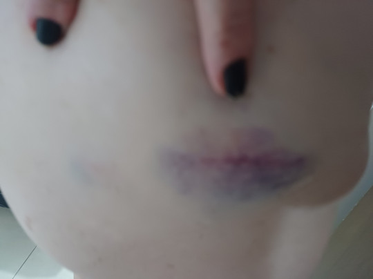 Bar E Restaurant Da Lagosta