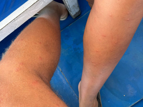 费尔勒海滨酒店主图