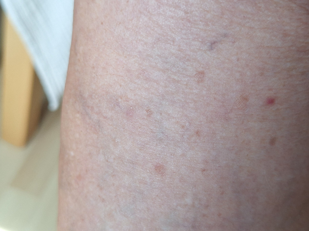 阿尔巴特罗斯酒店主图