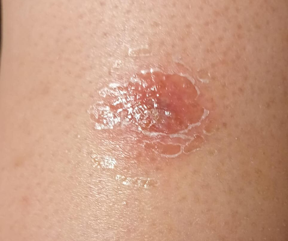 SpringHill Suites Cape Canaveral Cocoa Beach主图