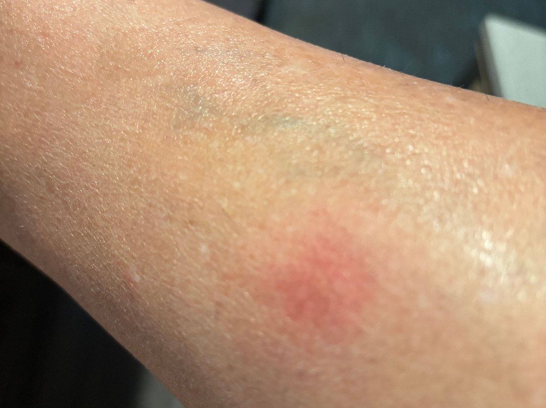 SureStay Hotel By Best Western San Rafael主图