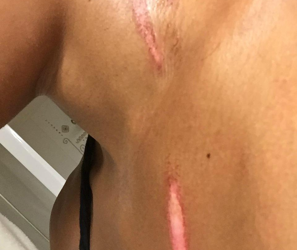 Mangofil en Guadeloupe