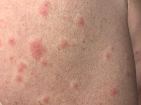 绿山墙汽车旅馆主图