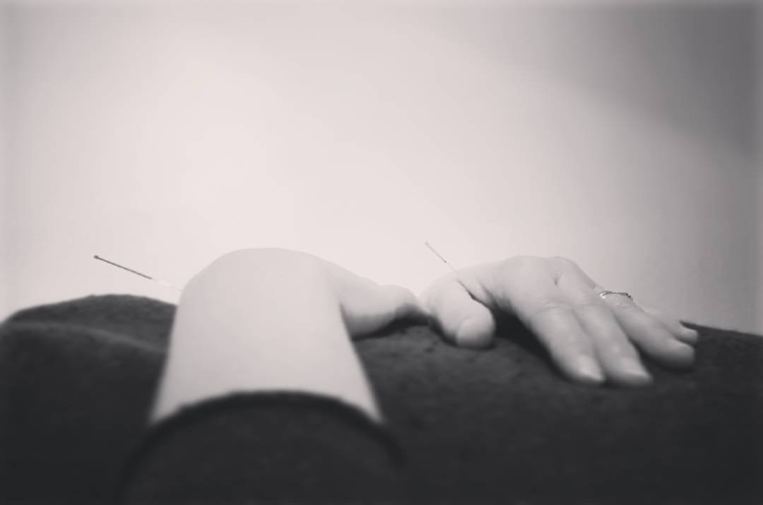 Mango Acupuncture景点图片