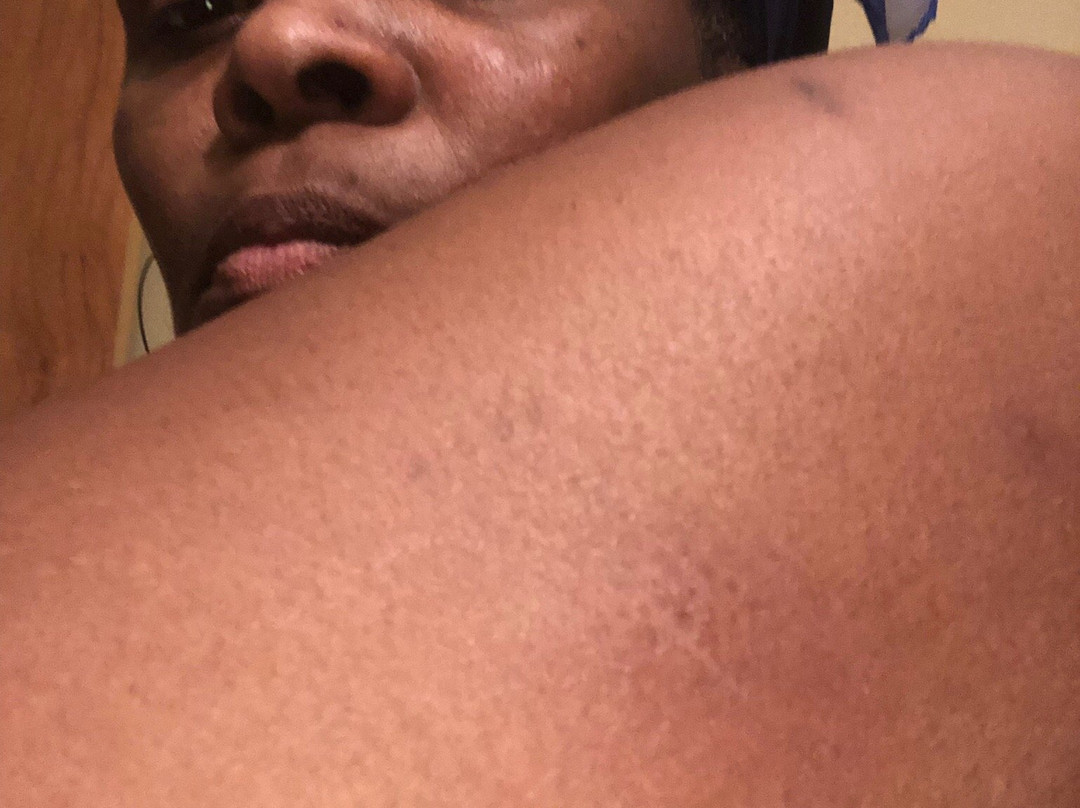 Drury Inn & Suites St. Louis O'Fallon, IL主图