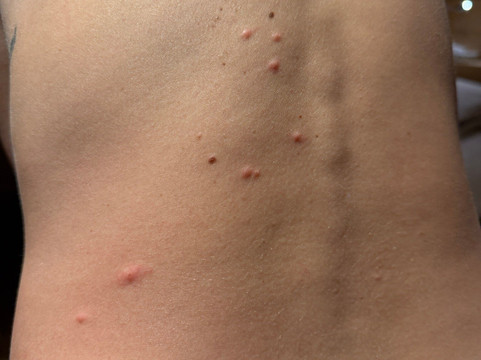 阿尔卑弗勒里酒店及公寓主图