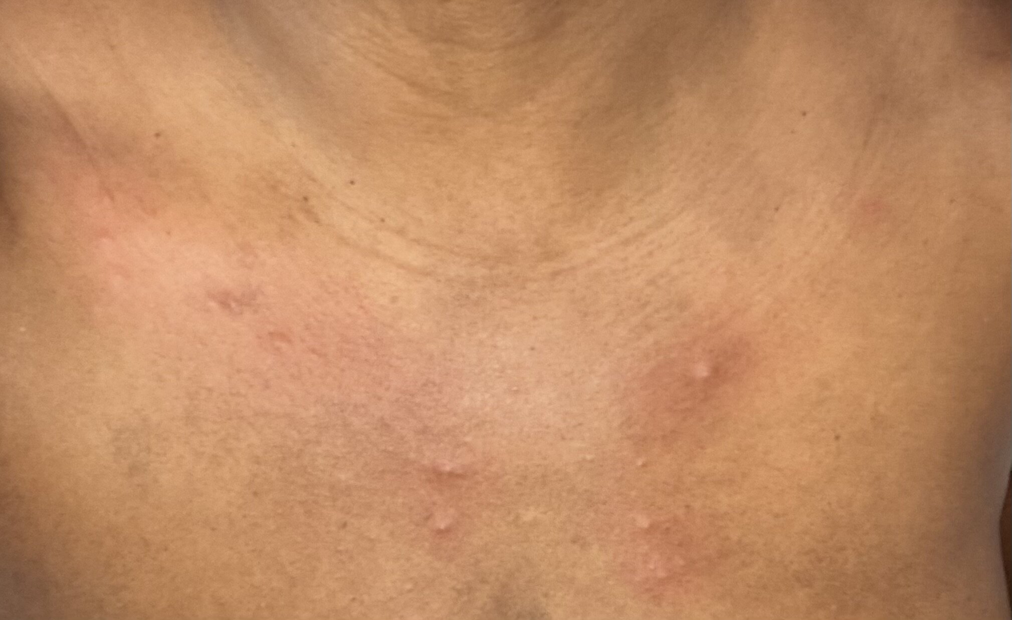 TownePlace Suites by Marriott Plant City-官方