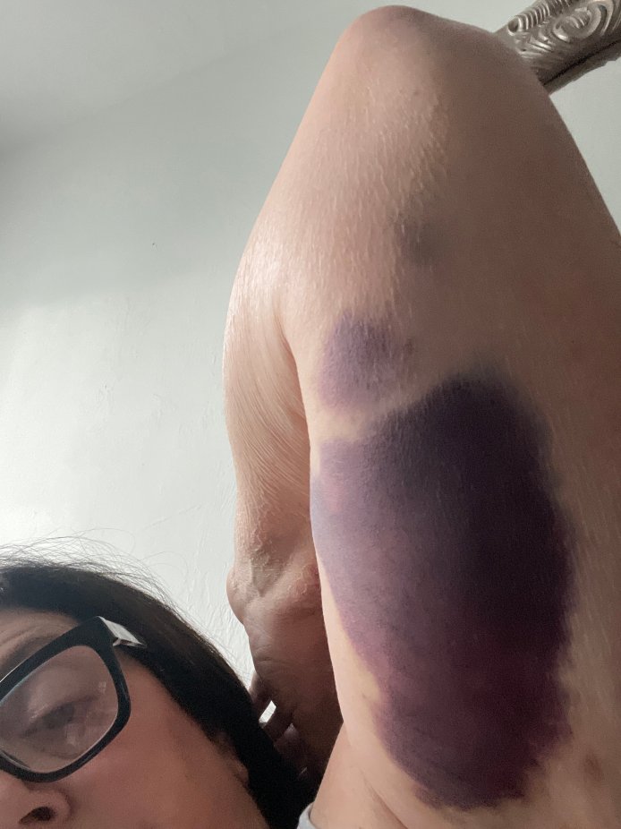 温斯顿塞勒姆拉昆塔温德姆套房酒店-官方