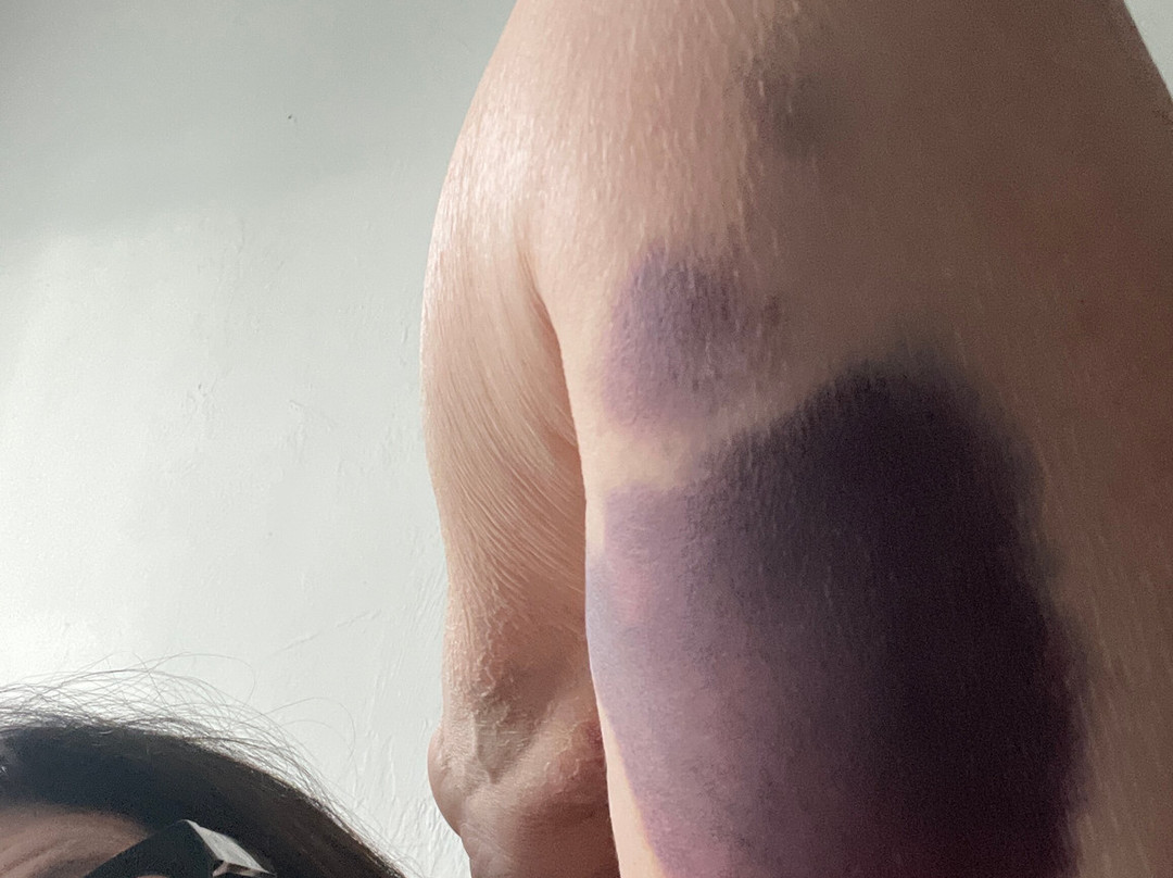 温斯顿塞勒姆拉昆塔温德姆套房酒店主图