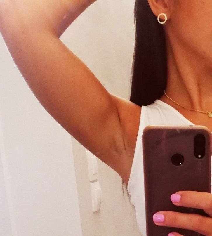 Kalnterimi-Parthenonas必去景点