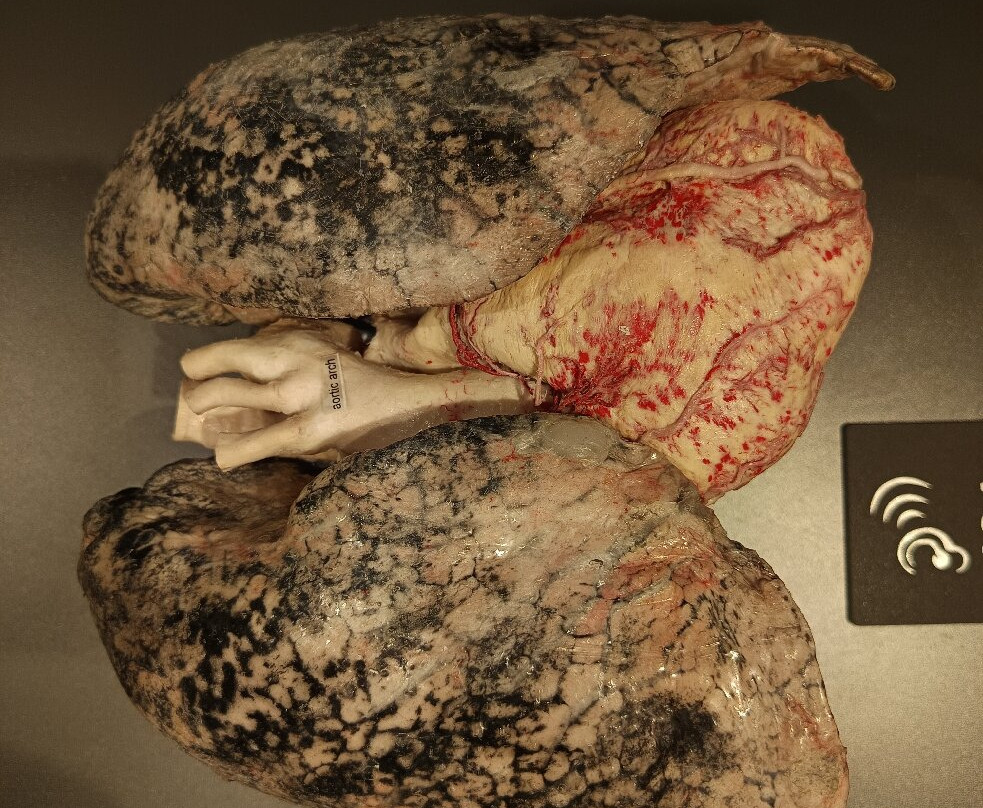 人体世界展览-阿姆斯特丹必去景点