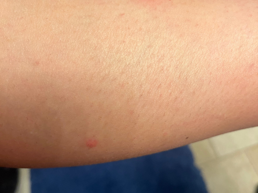 Candlewood Suites Boston North Shore - Danvers by IHG主图