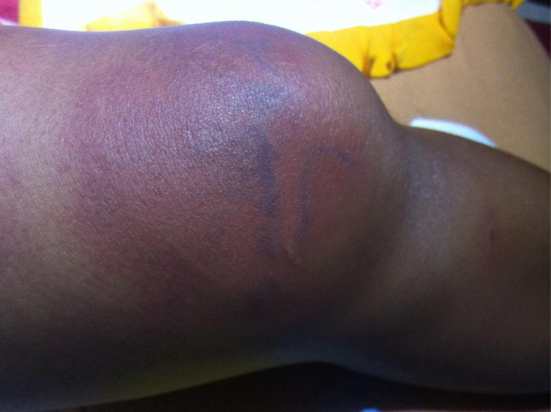 Kep Beach-白马必去景点