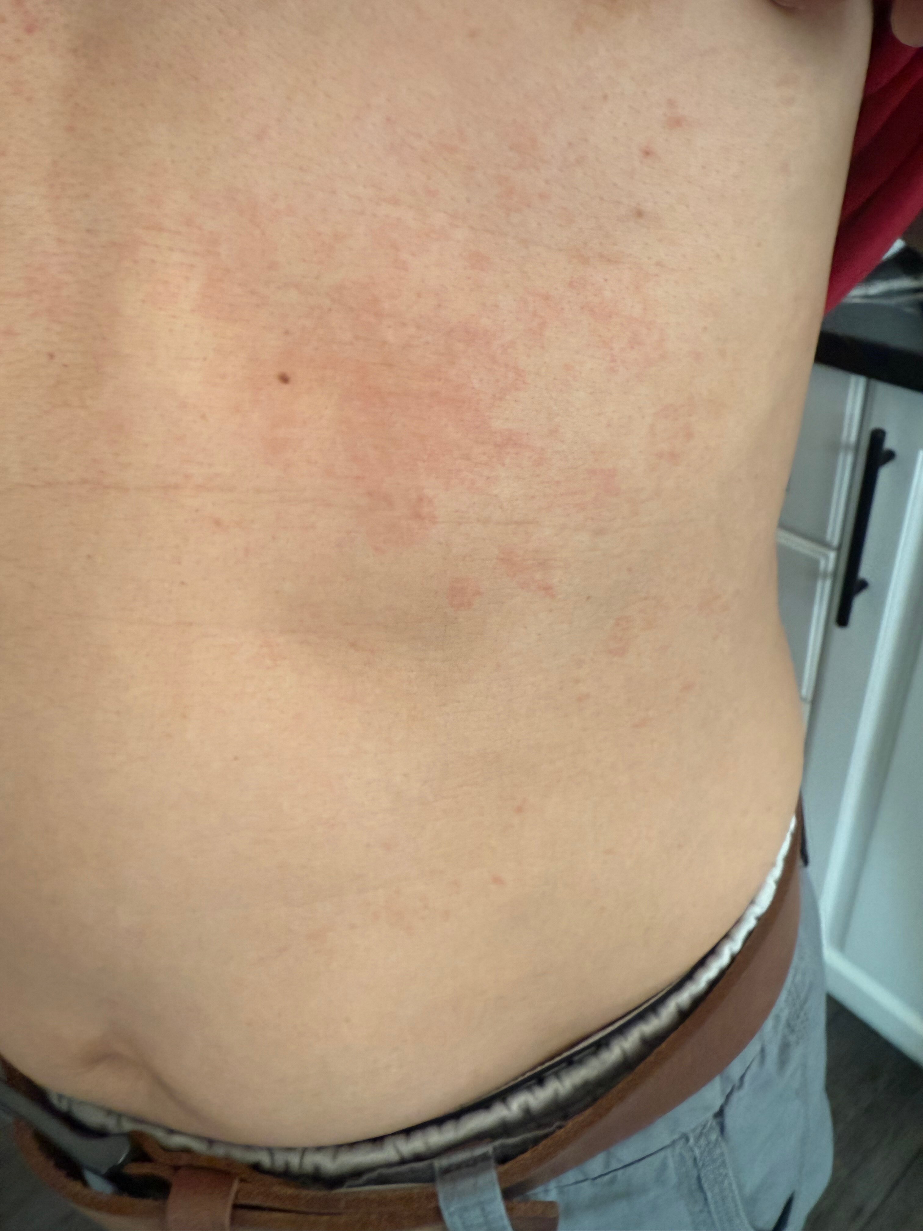 Hampton Inn & Suites by Hilton Toronto Airport-官方