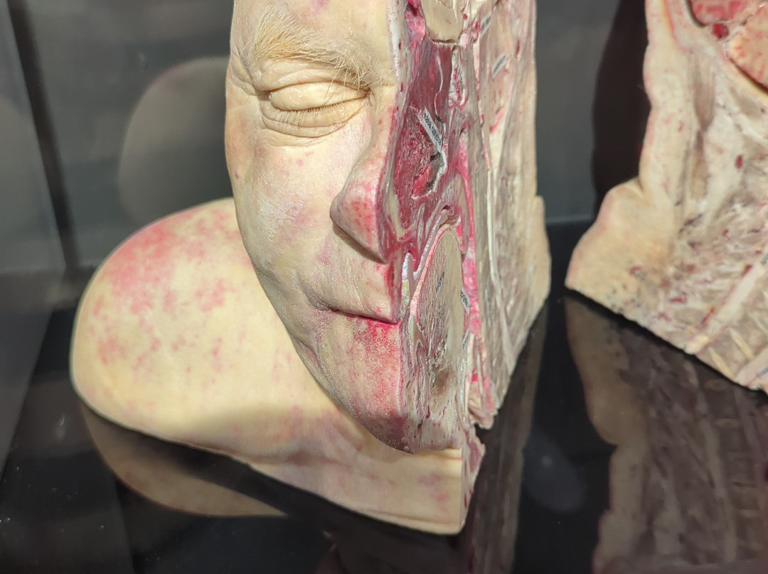 人体世界展览-阿姆斯特丹必去景点