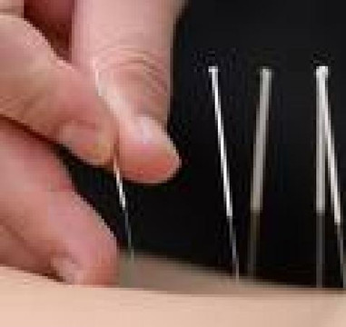 Acupuncture Works-帕利斯岛必去景点
