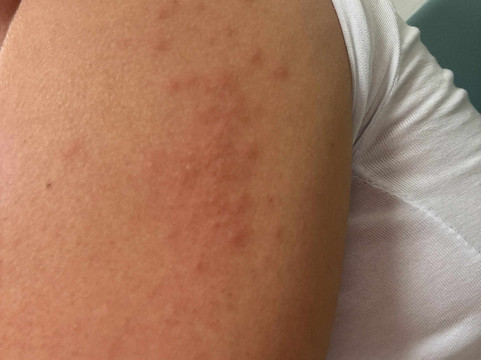 雅典中心纳弗斯卡酒店主图