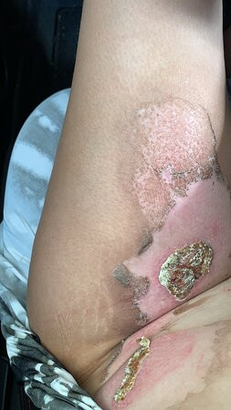 Hotel Bosque Escondido主图