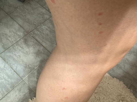 雅典中心纳弗斯卡酒店主图