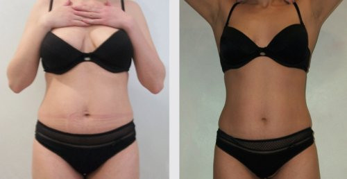 Via Vasilisa-Agios Tychon必去景点