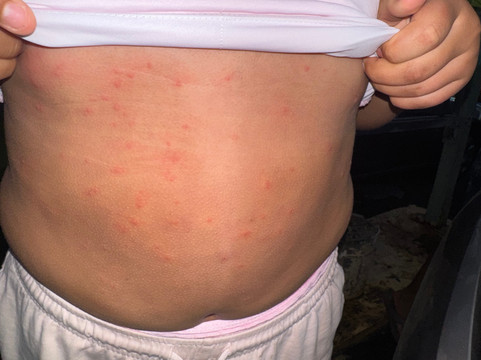 彭塔波林奎恩度假村主图