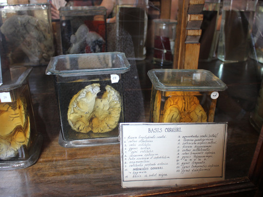 Museum of Human Anatomy-敖德萨必去景点