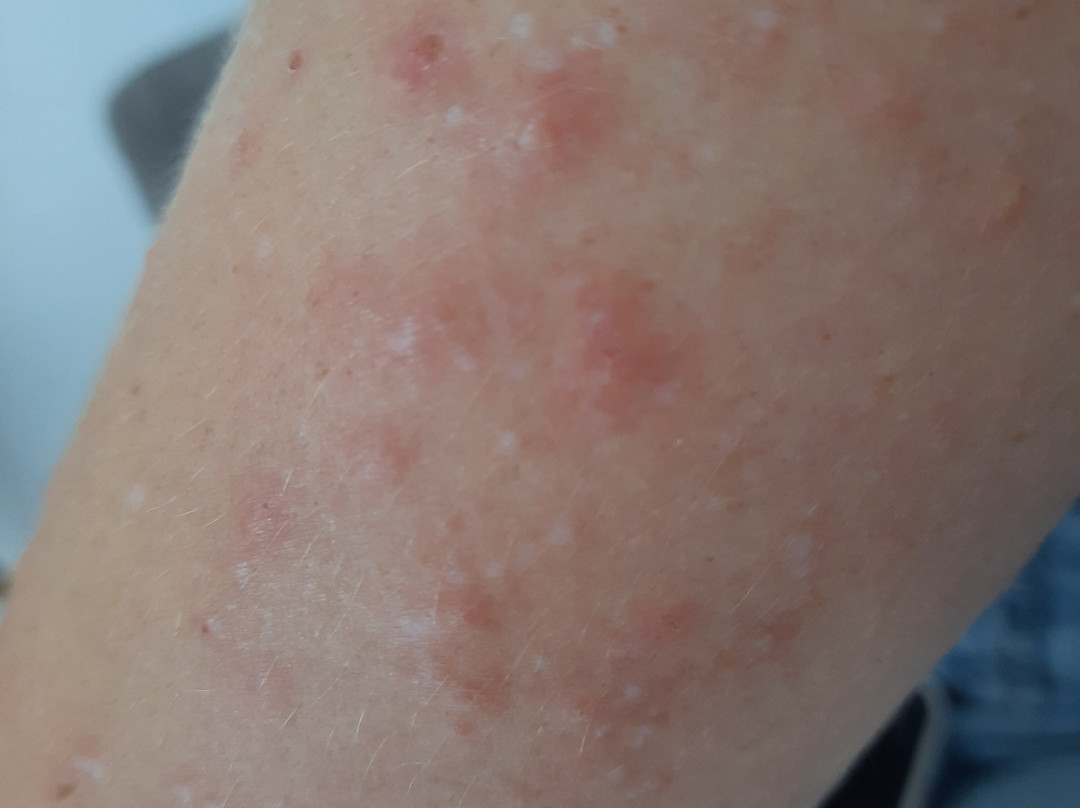 Plan d'Eau du Canada-博韦必去景点