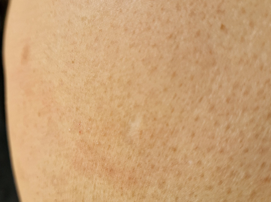 埃康姆查安度假酒店主图