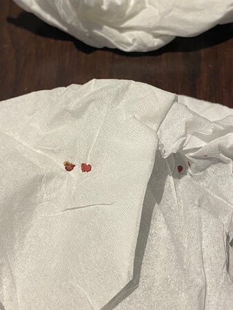 Ocean's Edge Hotel, Port Aransas TX主图