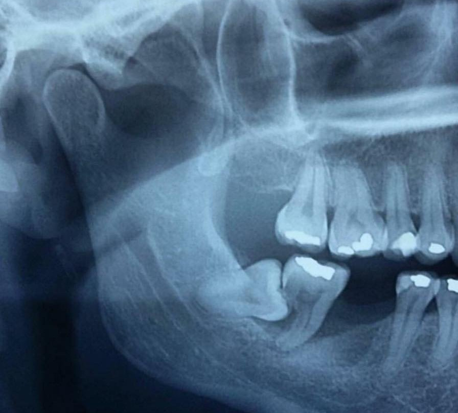 Papantla-韦拉克鲁斯必去景点