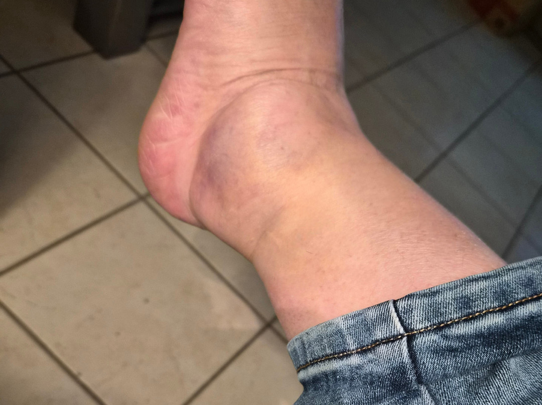 Le Kabaret-Tinqueux必去景点