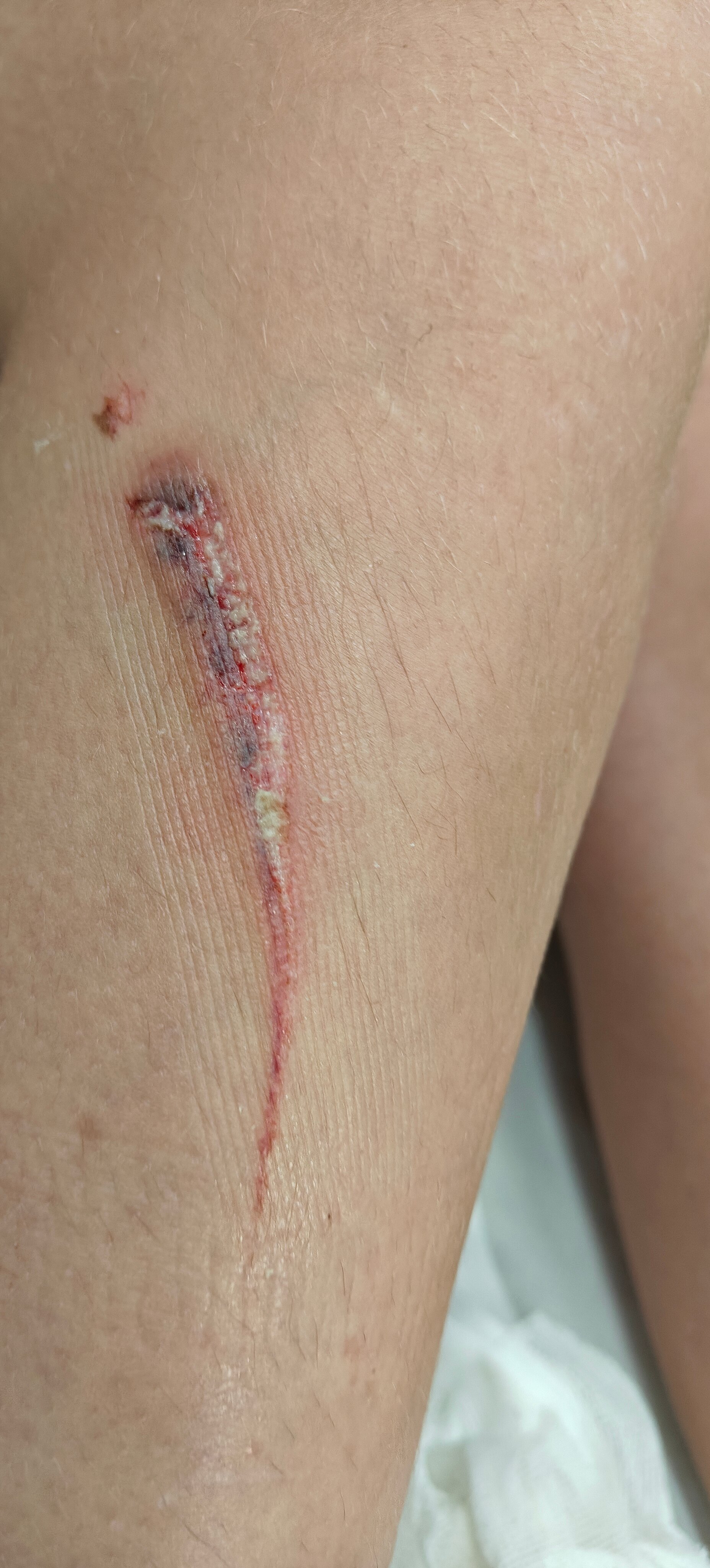 安达卢斯宫希尔肯酒店-泳池