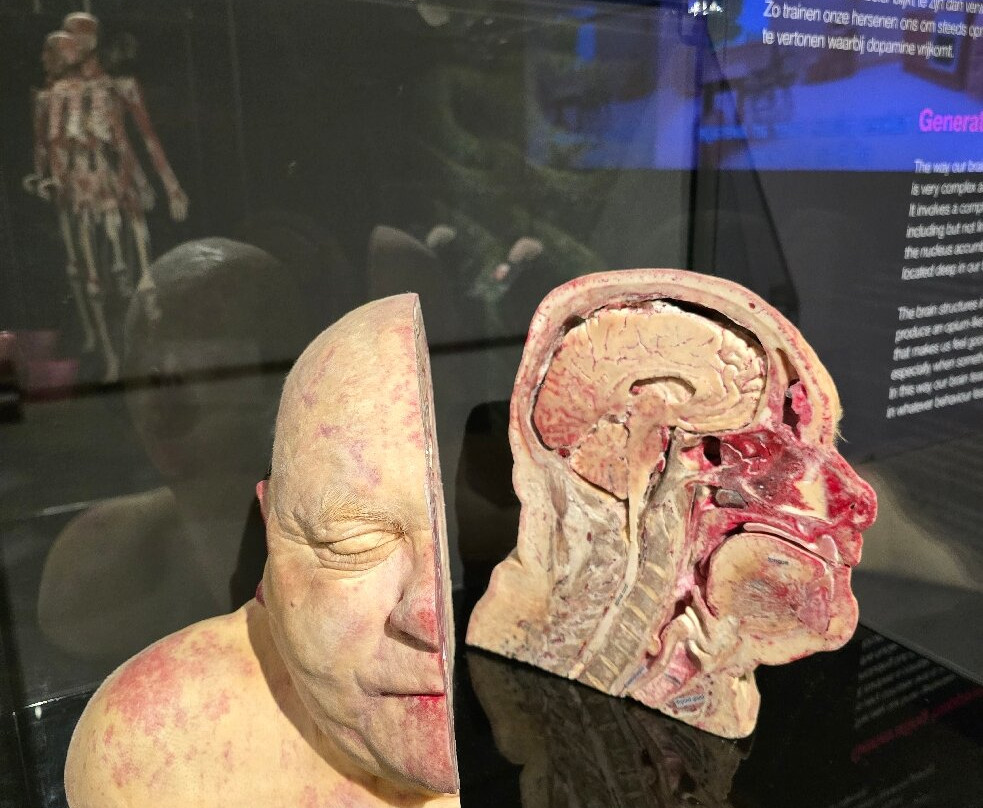 人体世界展览-阿姆斯特丹必去景点