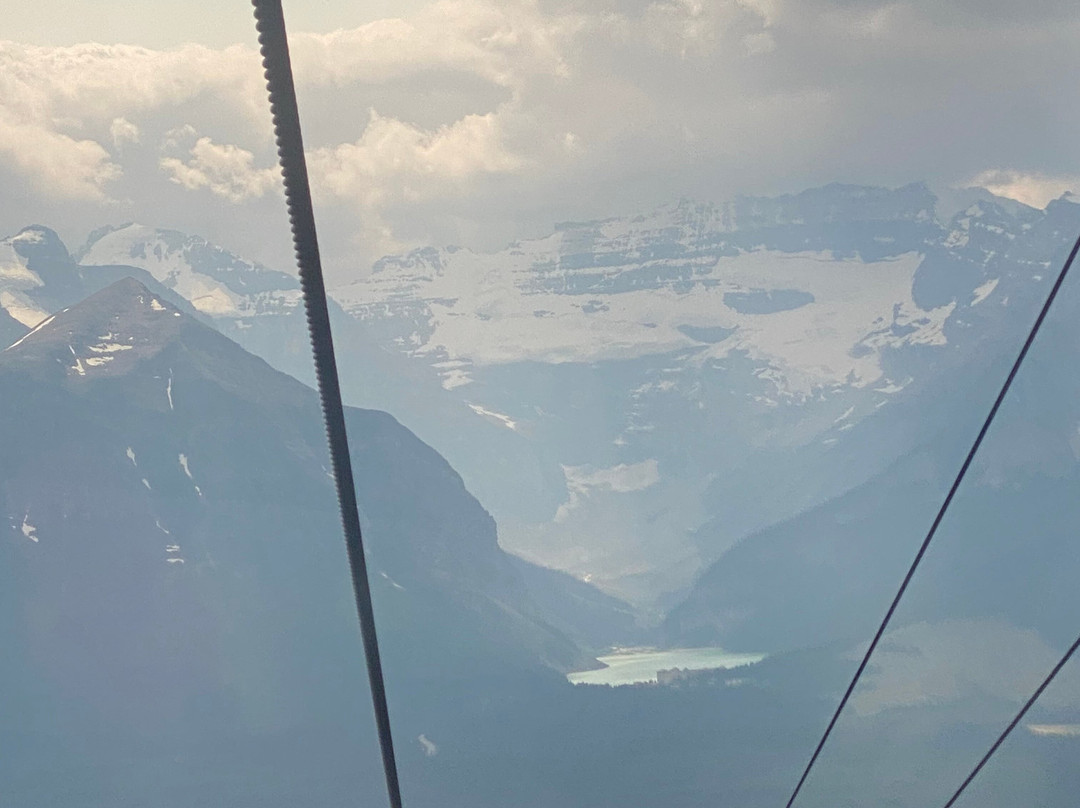 Lake Louise Sightseeing Gondola-路易斯湖必去景点