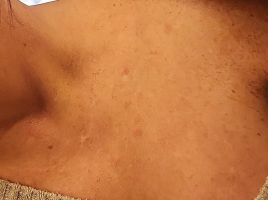 Springhill Suites St. Paul Arden Hills主图