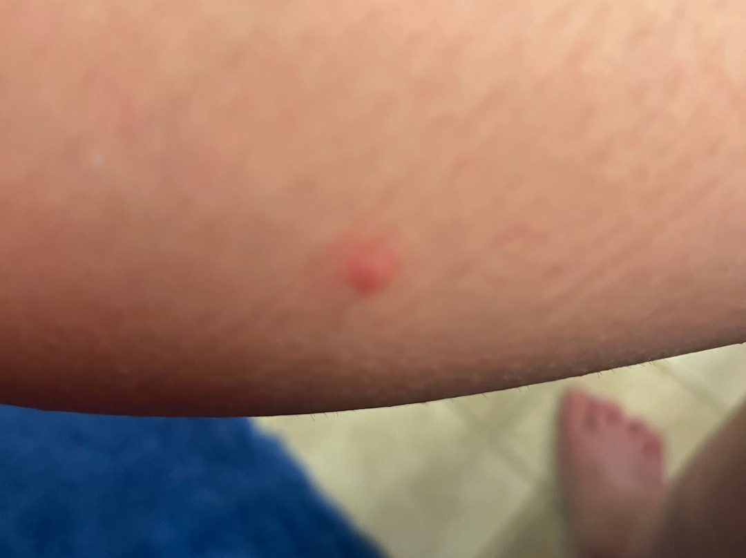 Candlewood Suites Boston North Shore - Danvers by IHG主图