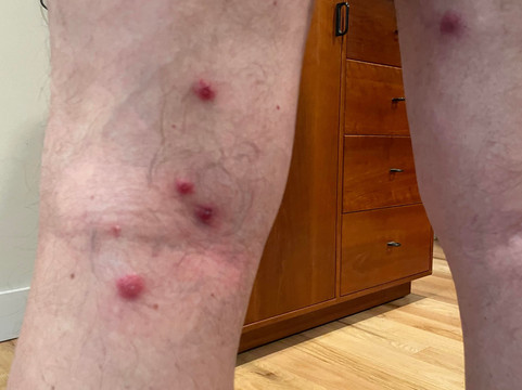 教堂山雅乐轩酒店主图