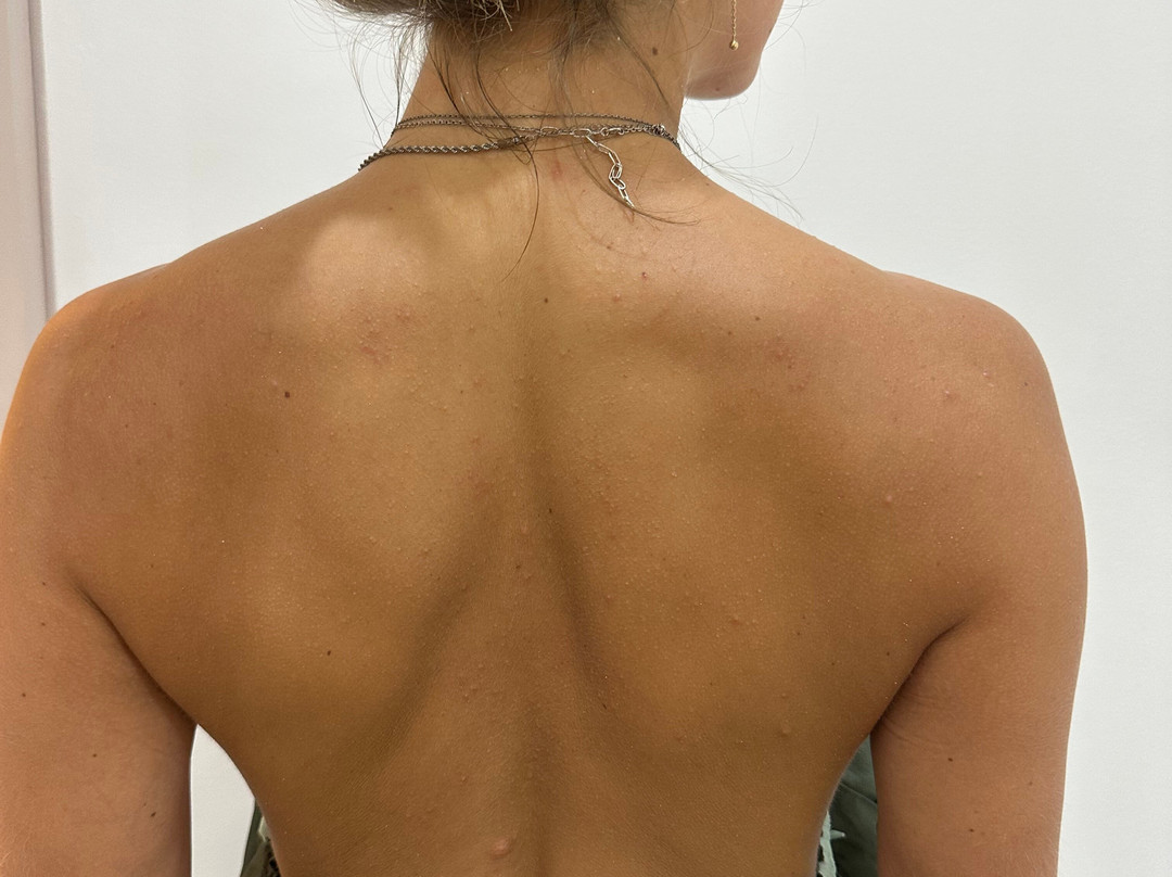 Lumina Aesthetics Clinic - SPA-Kuta Selatan必去景点